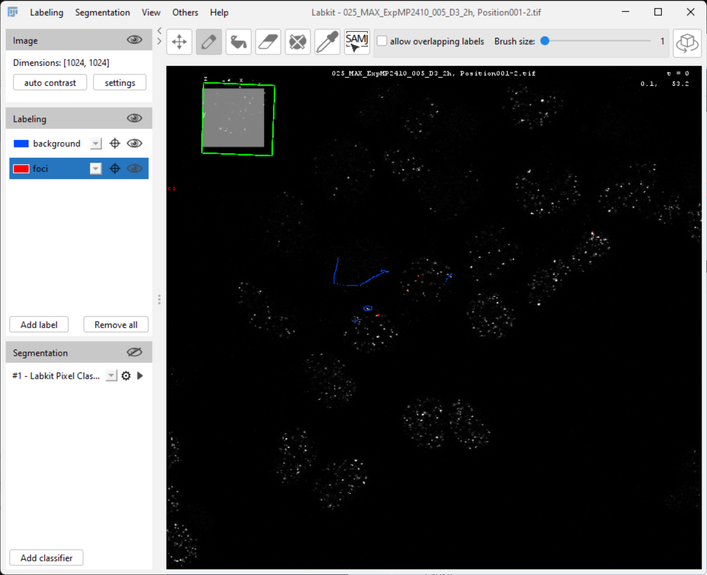 Labkit interface with segmentation