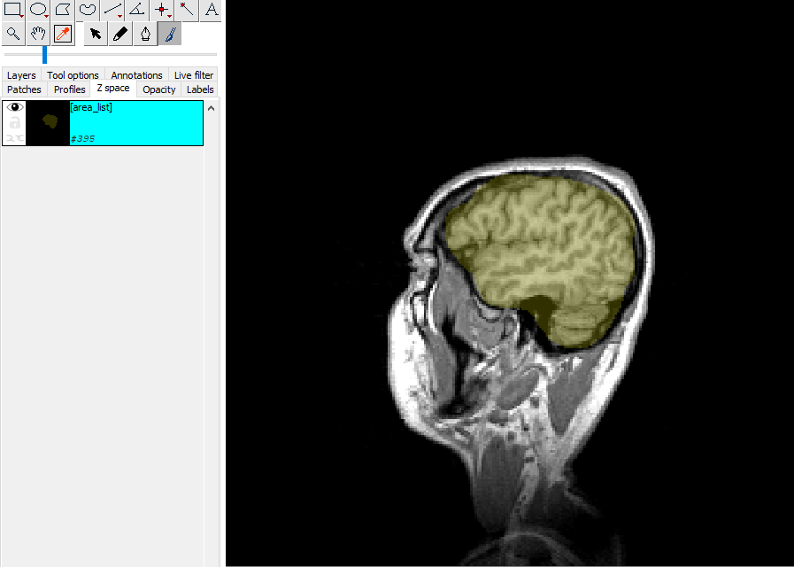 TrakEM2 with marked brain regions
